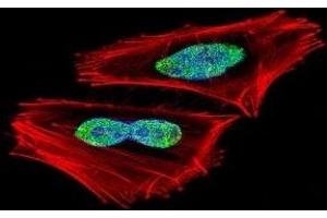 Fluorescent confocal image of A2058 cell stained with RBPJ antibody. (RBPJ Antikörper  (AA 1-29))