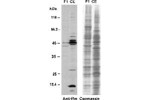 Western blot analysis of proteins from the eyespot fraction F1 and a CE with the anti-methyl-arginine specific antibody 7E6. (Methylated Arginine (MMA+ADMA+SDMA) Antikörper)