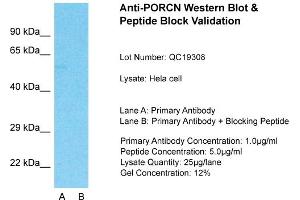 Host: Rabbit  Target Name: PORCN  Sample Tissue: Hela Whole cell  Lane A:  Primary Antibody Lane B:  Primary Antibody + Blocking Peptide Primary Antibody Concentration: 1 µg/mL Peptide Concentration: 5 µg/mL Lysate Quantity: 41 µg/laneGel Concentration:. (PORCN Antikörper  (N-Term))