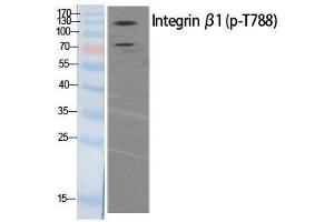 Western Blot analysis of HeLa extracts of mitotic cells generated by treatment with Phospho-ITGB1 (Thr788) Polyclonal Antibody (ITGB1 Antikörper  (pThr788))
