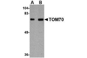 Image no. 1 for anti-Translocase of Outer Mitochondrial Membrane 70 (TOMM70A) (Internal Region) antibody (ABIN341714) (TOM70 Antikörper  (Internal Region))