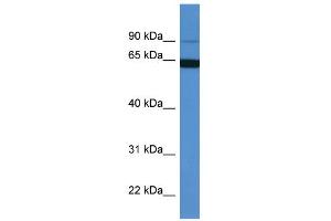WB Suggested Anti-MAP6 Antibody Titration: 0. (MAP6 Antikörper  (N-Term))