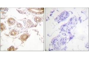 Immunohistochemistry analysis of paraffin-embedded human skin, using ETK (Phospho-Tyr40) Antibody. (BMX Antikörper  (pTyr40))