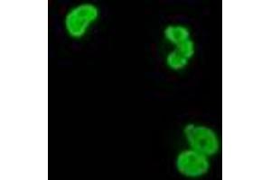 Anti-XRCC1 mouse monoclonal antibody (ABIN2453797) immunofluorescent staining of COS7 cells transiently transfected by pCMV6-ENTRY XRCC1 (RC204952). (XRCC1 Antikörper)