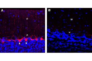 Expression of GABA Transporter 1 in rat cerebellum. (GABA Transporter 1 (GAT1) Peptid)