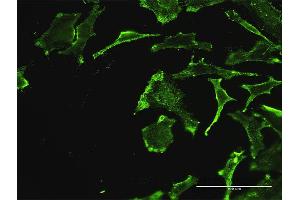Immunofluorescence of monoclonal antibody to REN on HeLa cell. (Renin Antikörper  (AA 24-406))