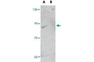 Western blot analysis of FAM59A in rat liver tissue lysate with FAM59A polyclonal antibody  at (A) 1 and (B) 2 ug/mL . (FAM59A Antikörper  (C-Term))