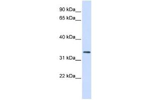 FBXO25 antibody used at 1 ug/ml to detect target protein. (FBXO25 Antikörper  (N-Term))