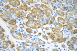 anti-Cystathionine-beta-Synthase (CBS) antibody