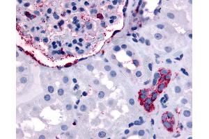 Anti-ERBB4 antibody IHC of human kidney. (ERBB4 Antikörper  (Internal Region))