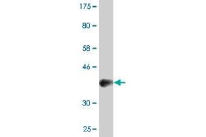 Western Blot detection against Immunogen (37. (PAX8 Antikörper  (AA 141-250))