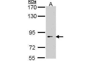 WB Image Sample (30 ug of whole cell lysate) A: Hep G2 , 7. (BBS12 Antikörper)