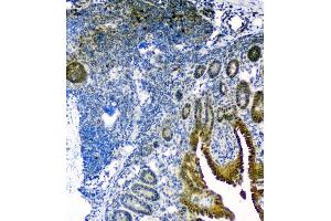 IHC analysis of Thioredoxin TRX using anti-Thioredoxin TRX antibody (ABIN6719381).