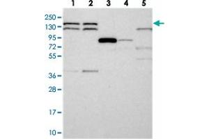 Western blot analysis of Lane 1: RT-4, Lane 2: U-251 MG, Lane 3: Human Plasma, Lane 4: Liver, Lane 5: Tonsil with DHX38 polyclonal antibody  at 1:250-1:500 dilution. (DHX38 Antikörper)