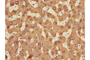 Immunohistochemistry of paraffin-embedded human liver tissue using ABIN7158476 at dilution of 1:100