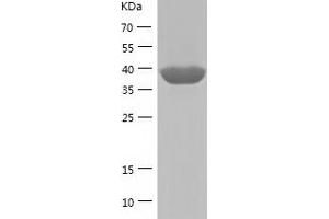 Western Blotting (WB) image for Apolipoprotein B mRNA Editing Enzyme, Catalytic Polypeptide-Like 4 (Putative) (APOBEC4) (AA 1-367) protein (His tag) (ABIN7121867) (APOBEC4 Protein (AA 1-367) (His tag))