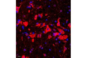 Immunofluorescence of paraffin embedded mouse epencephalon using UTS2 (ABIN7076162) at dilution of 1:2000 (400x lens) (Urotensin 2 Antikörper)