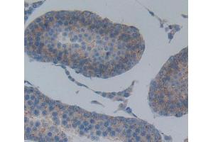 Used in DAB staining on fromalin fixed paraffin- embedded testis tissue (ABCB8 Antikörper  (AA 468-714))