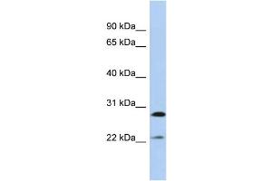 Host:  Rabbit  Target Name:  FGB  Sample Type:  MCF7 Whole Cell lysates  Antibody Dilution:  1. (Fibrinogen beta Chain Antikörper  (Middle Region))