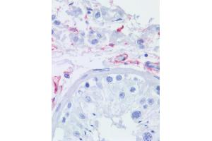 Immunohistochemistry staining of human testis (paraffin sections) using anti-CD271 (NGFR5).