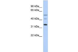 WB Suggested Anti-TCP11 Antibody Titration: 0. (TCP11 Antikörper  (Middle Region))