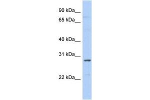 WB Suggested Anti-SNRPA1 Antibody Titration:  0. (SNRPA1 Antikörper  (N-Term))