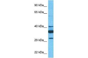 Host:  Rabbit  Target Name:  SLC35C1  Sample Type:  721_B Whole Cell lysates  Antibody Dilution:  1. (SLC35C1 Antikörper  (C-Term))