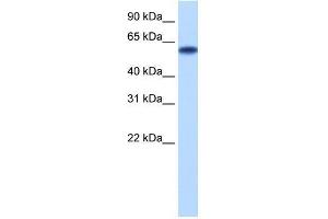 Transfected 293T; WB Suggested Anti-ZNF394 Antibody Titration: 0. (ZNF394 Antikörper  (N-Term))