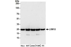 anti-LSM12 Homolog B (LSM12B) (AA 145-195) antibody