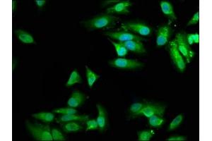 Immunofluorescence staining of Hela cells with ABIN7149997 at 1:100, counter-stained with DAPI. (MVD Antikörper  (AA 69-221))