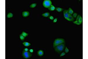 Immunofluorescent analysis of PC-3 cells using ABIN7163117 at dilution of 1:100 and Alexa Fluor 488-congugated AffiniPure Goat Anti-Rabbit IgG(H+L) (TAM41 Antikörper  (AA 161-452))