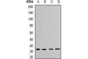 Western blot analysis of CapZ alpha-2 expression in Hela (A), THP1 (B), mouse brain (C), mouse heart (D) whole cell lysates. (CAPZA2 Antikörper)