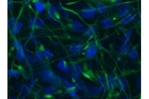 Image no. 1 for anti-Nestin (NES) antibody (ABIN335378) (Nestin Antikörper)