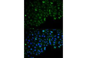 Immunofluorescence analysis of U2OS cell using HK2 antibody. (Hexokinase 2 Antikörper)