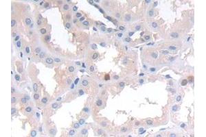 Detection of NCAD in Human Kidney Tissue using Polyclonal Antibody to N-cadherin (NCAD) (N-Cadherin Antikörper  (AA 685-784))