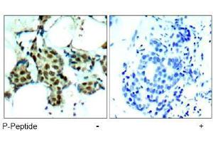 Image no. 1 for anti-Mitogen-Activated Protein Kinase 14 (MAPK14) (pTyr182) antibody (ABIN197012) (MAPK14 Antikörper  (pTyr182))