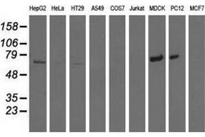 Western blot analysis of extracts (35 µg) from 9 different cell lines by using anti-MTMR14 monoclonal antibody. (MTMR14 Antikörper)