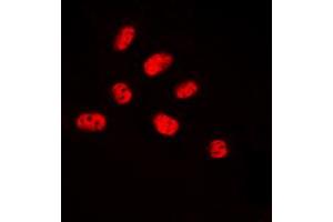 Immunofluorescent analysis of NET (pS357) staining in HUVEC cells. (ELK3 Antikörper  (C-Term, pSer357))
