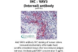 Image no. 2 for anti-Vav 3 Oncogene (VAV3) (Internal Region) antibody (ABIN1740680) (VAV3 Antikörper  (Internal Region))