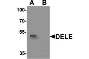 Western blot analysis of DELE in rat brain tissue lysate with DELE Antibody  at 1 ug/ml in (A) the absence and (B) the presence of blocking peptide.