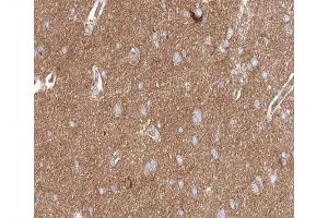 ABIN6267617 at 1/200 staining human brain tissue sections by IHC-P. (PKC delta Antikörper  (pSer645))
