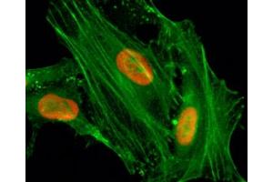 ICC/IF staining of HeLa cells treated with sodium butyrate using recombinant H4K8ac antibody (red).