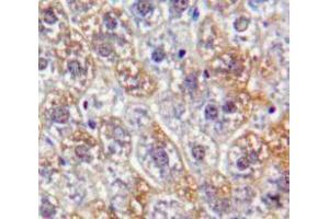 IHC-P analysis of Liver tissue, with DAB staining. (PKN2 Antikörper  (AA 282-487))