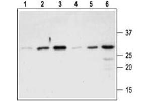 Western blot analysis of Recombinant mouse proNGF protein (#N-250), (lanes 1-3) and Recombinant human proNGF protein (#N-280), (lanes 4-6): - 1,4. (Nerve Growth Factor Antikörper  (Pro-Domain))