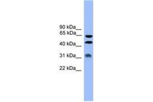 Image no. 1 for anti-serpin Peptidase Inhibitor, Clade A (Alpha-1 Antiproteinase, Antitrypsin), Member 4 (SERPINA4) (AA 271-320) antibody (ABIN6745377) (SERPINA4 Antikörper  (AA 271-320))