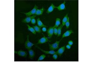IF analysis of AS160/TBC1D4 using anti-AS160/TBC1D4 antibody (ABIN7599745). (TBC1D4 Antikörper  (AA 1118-1298))