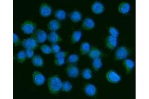 anti-Platelet Derived Growth Factor A (PDGFA) (AA 87-211) antibody