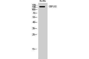 Western Blotting (WB) image for anti-Centrosomal Protein 152kDa (CEP152) (Internal Region) antibody (ABIN3174341) (CEP152 Antikörper  (Internal Region))