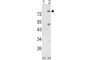 Western Blotting (WB) image for anti-Phosphoinositide-3-Kinase, Regulatory Subunit 5 (PIK3R5) antibody (ABIN3003638) (PIK3R5 Antikörper)
