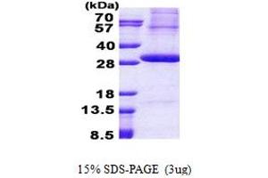 SDS-PAGE (SDS) image for Kallikrein 2 (KLK2) (AA 25-261) protein (His tag) (ABIN5853050)